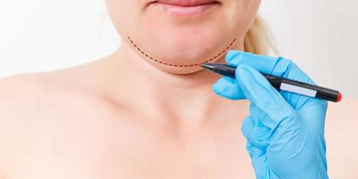 Chin Reduction in Jeddah: A Closer Look at Surgical Chin Refinement