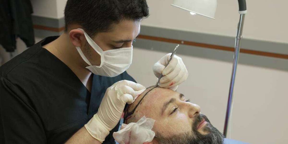Scarless Hair Transplant in Jeddah: A Guide to Minimal-Scar Hair Restoration